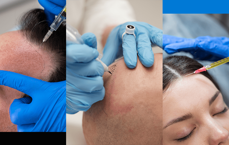 tricoderm-clinic-dermatologia-y-medicina-capilar-en-panama